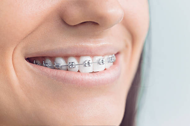 Best Dental Inlays and Onlays  in Lewisville, WA